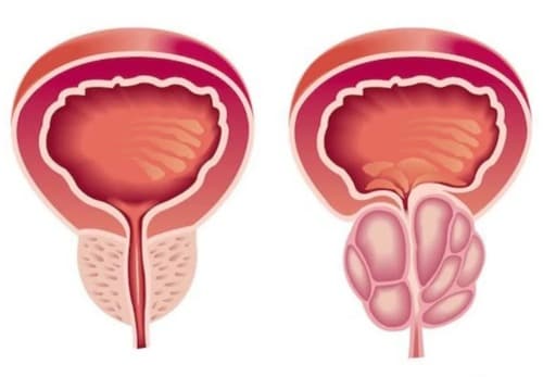 Erasmin medicamento opiniones