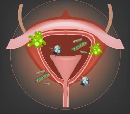 Urofemmin para que sirve